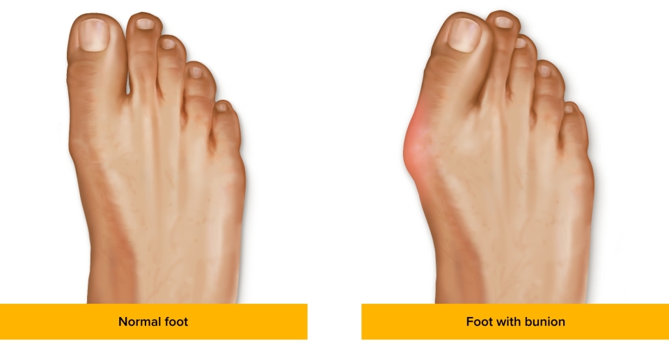 foot diagram