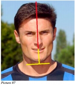 athlete posture starecta