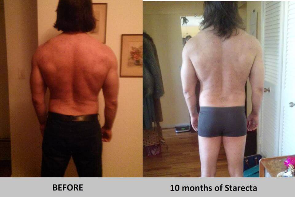 plato back