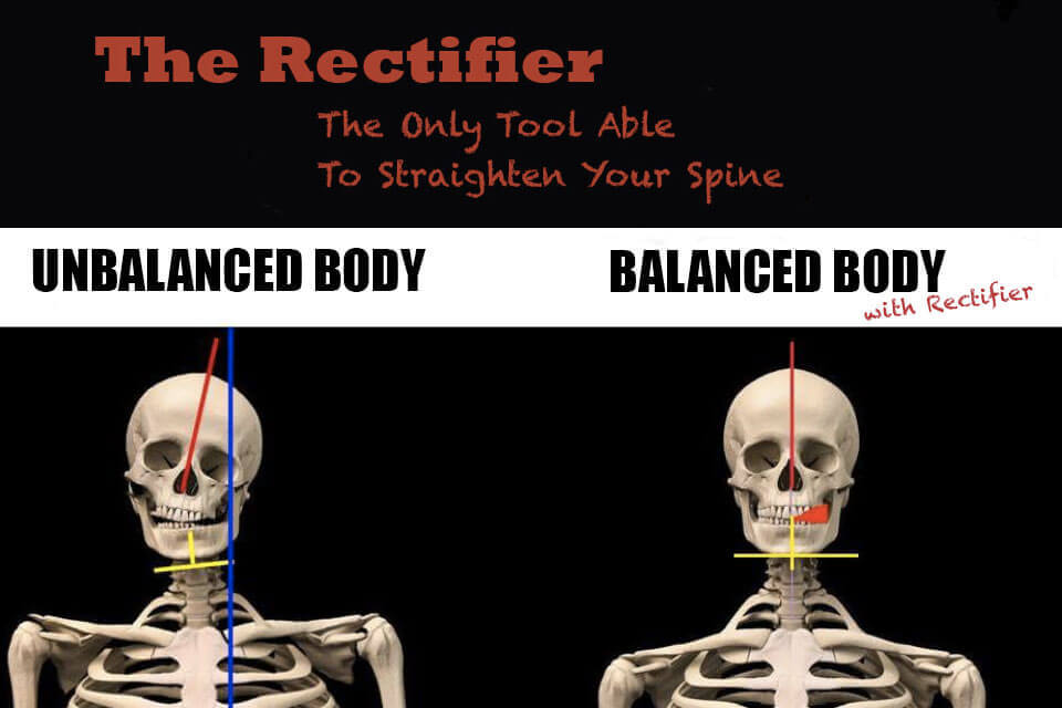 starecta rectifier
