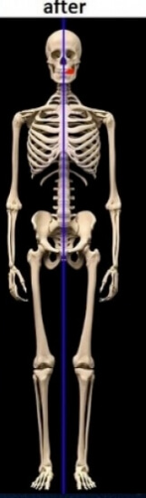 skeleton balanced