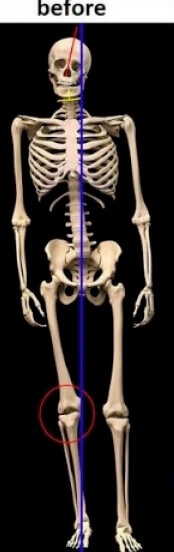 skeleton unbalanced