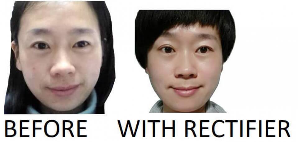 face symmetry