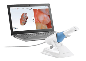 Dexis Imprevo Scanner