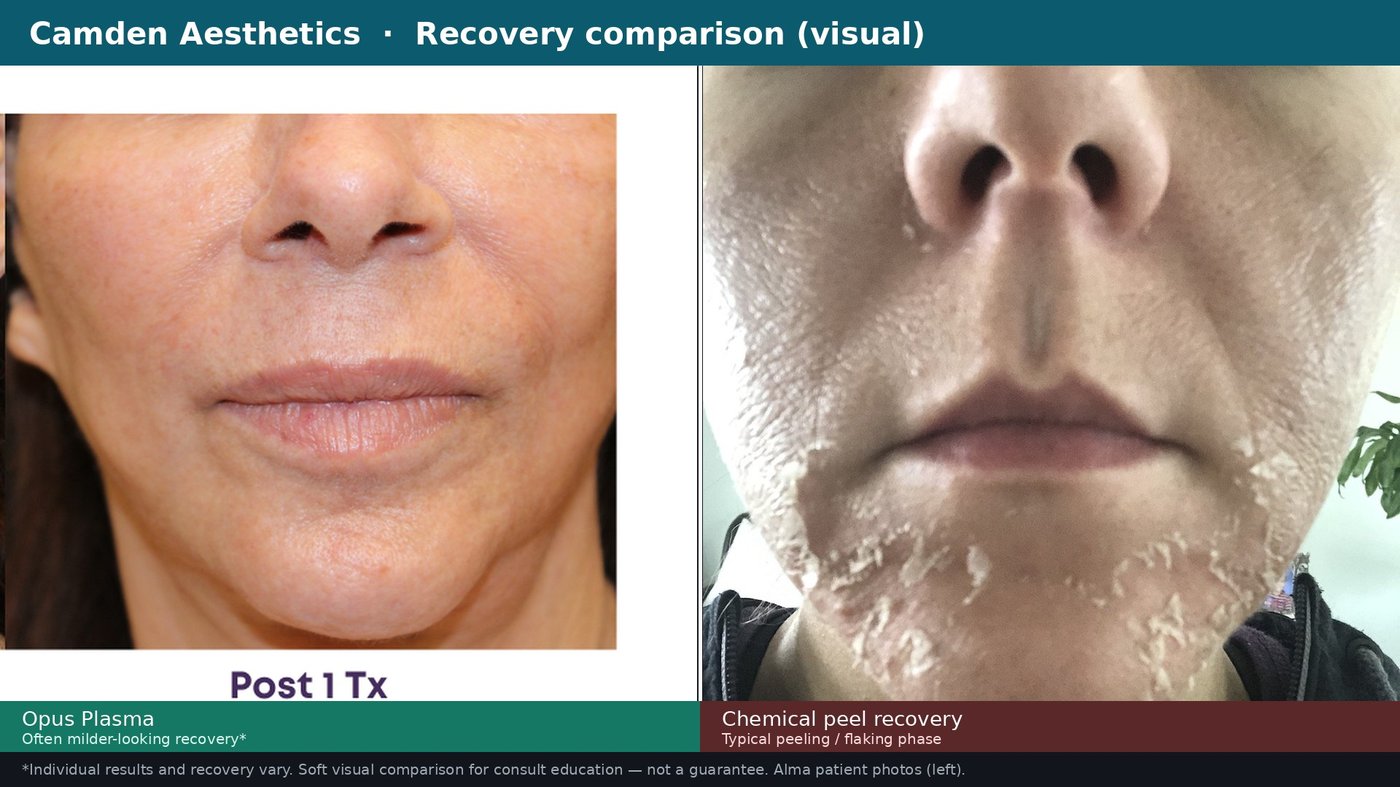 Opus vs chemical peel recovery comparison