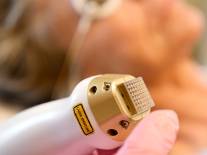 icon 1540 non-ablative laser for stretch marks removal