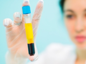 unique-to-you platelet serum enhances stretch marks removal and fading