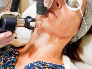 woman with neck wrinkles and crinkles gets a co2 laser treatment