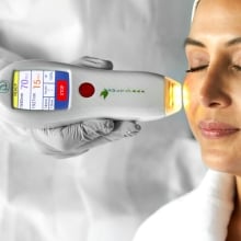 multifrax laser treatment performed on patient in denver skin clinic