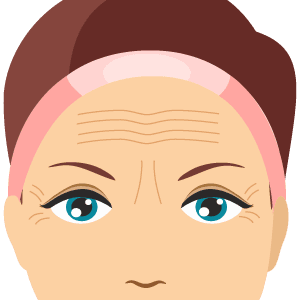 anti-wrinkle dysport tox injections for forehead lines, frown lines, and crows feet