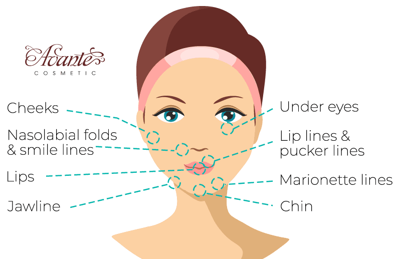 filler price for cheeks, nasolabial folds, lip filler, jawline, under eyes, pucker & lip lines, marionette lines, and chin