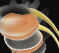 Back Pain Relief - Spinal Decompression