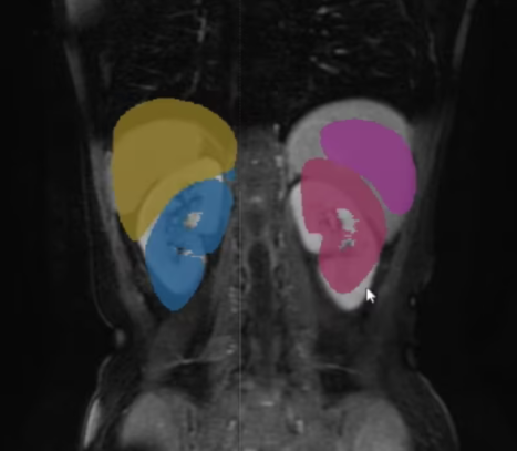 MRI Left and Right Swapped Problem