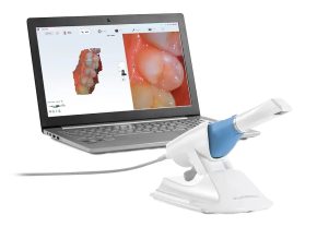 Dexis Imprevo Scanner