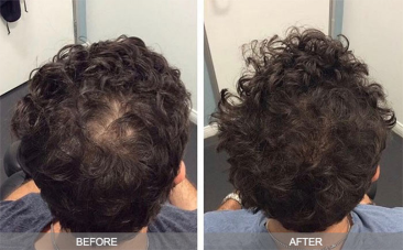 Images courtesy of Integrative Wellness NY Individual results may vary. 