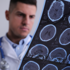 Seizures and Epilepsy Syndromes