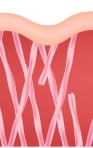 Skin collagen fibers