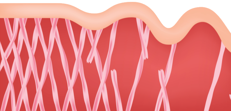 Collagen decline with age