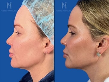 Before and after image