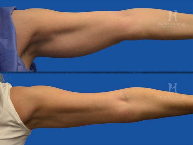 Before and after images