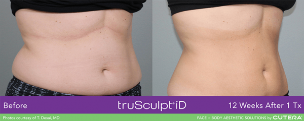 before and after image