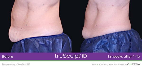 amy before and after image