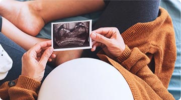 Schwangere Frau hält Ultraschall-Bild in der Hand