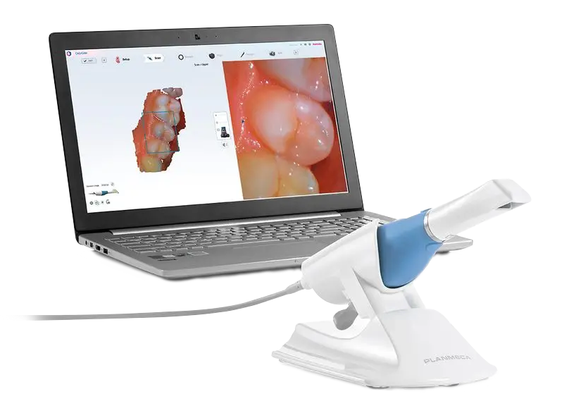 Dexis Imprevo Scanner