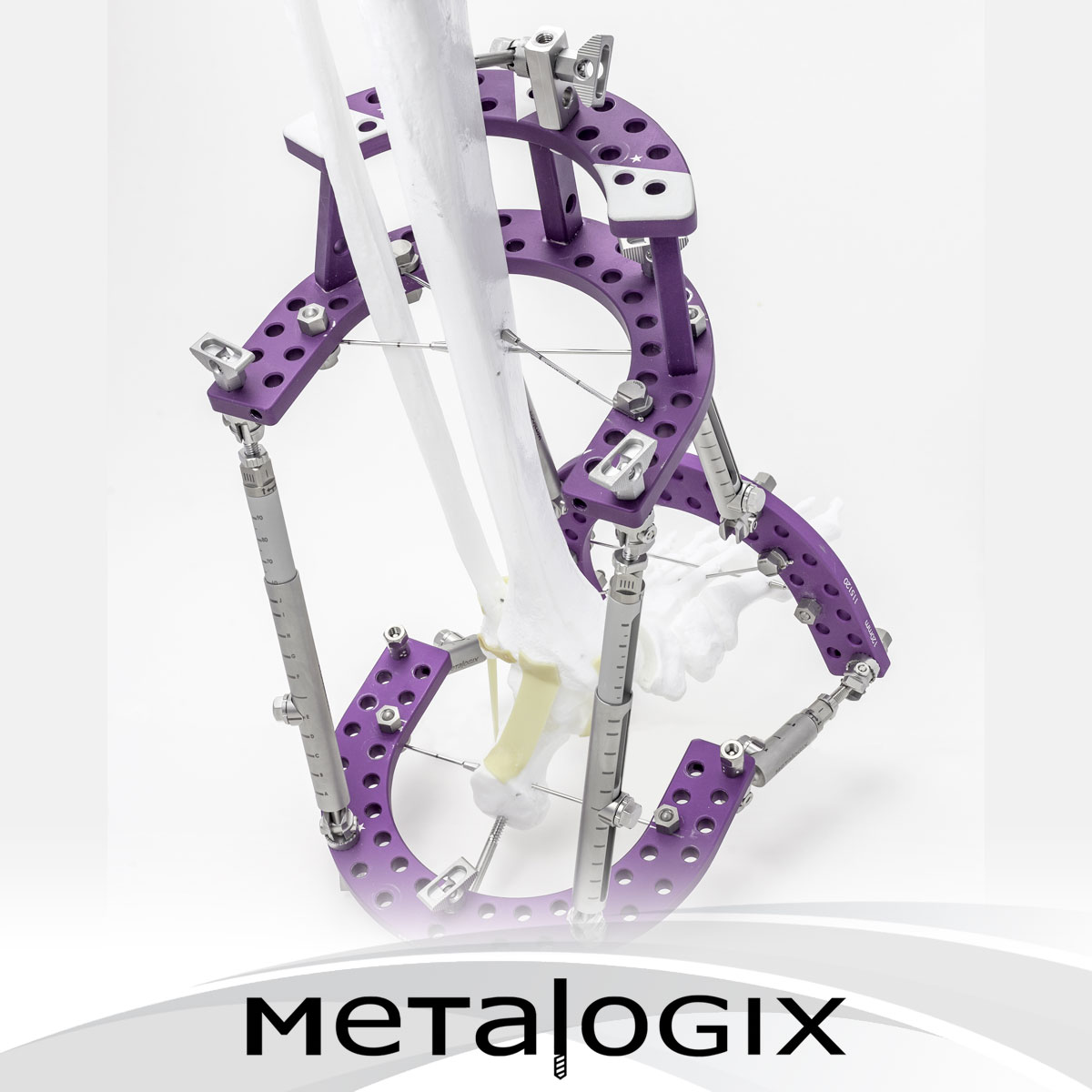 Metalogix Revolution External Fixation System