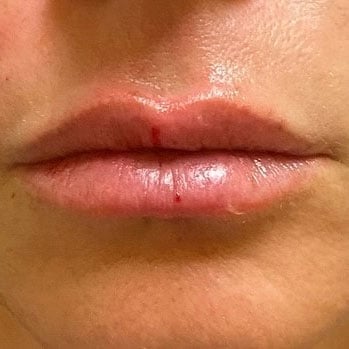 Close up image of a person's face