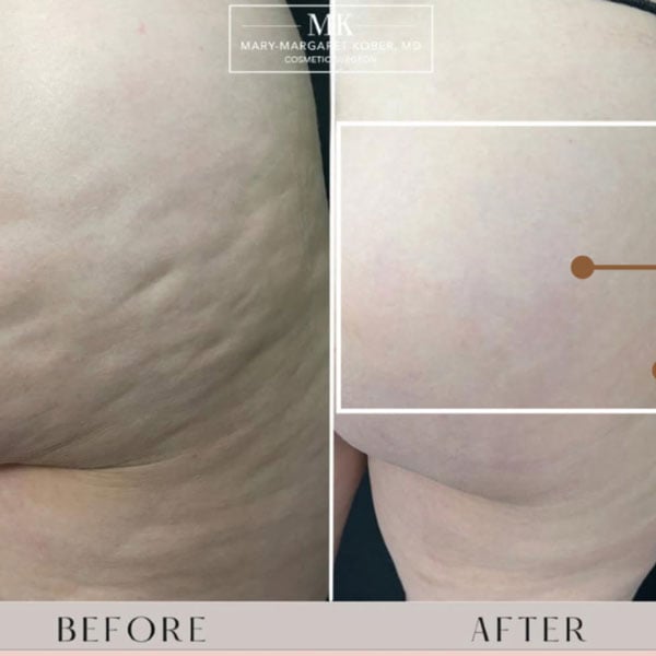 Close up image of a person's face