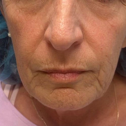 Close up image of a person's face