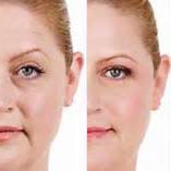 Close up image of a person's face