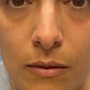 Close up image of a person's face