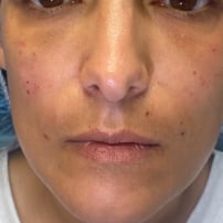 Close up image of a person's face