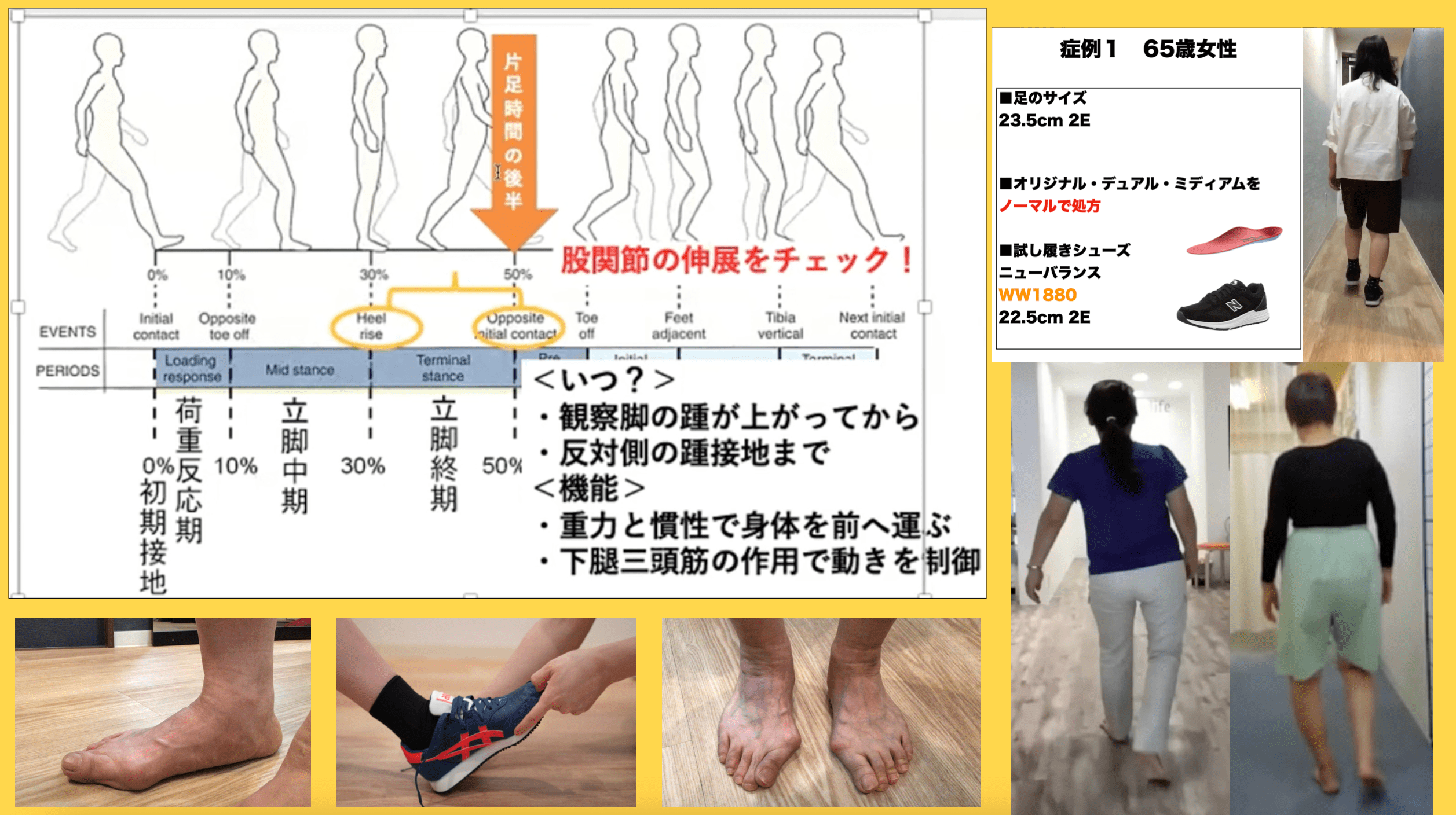 フォームソティックス・メディカル取扱認定講習会[国家資格者限定]