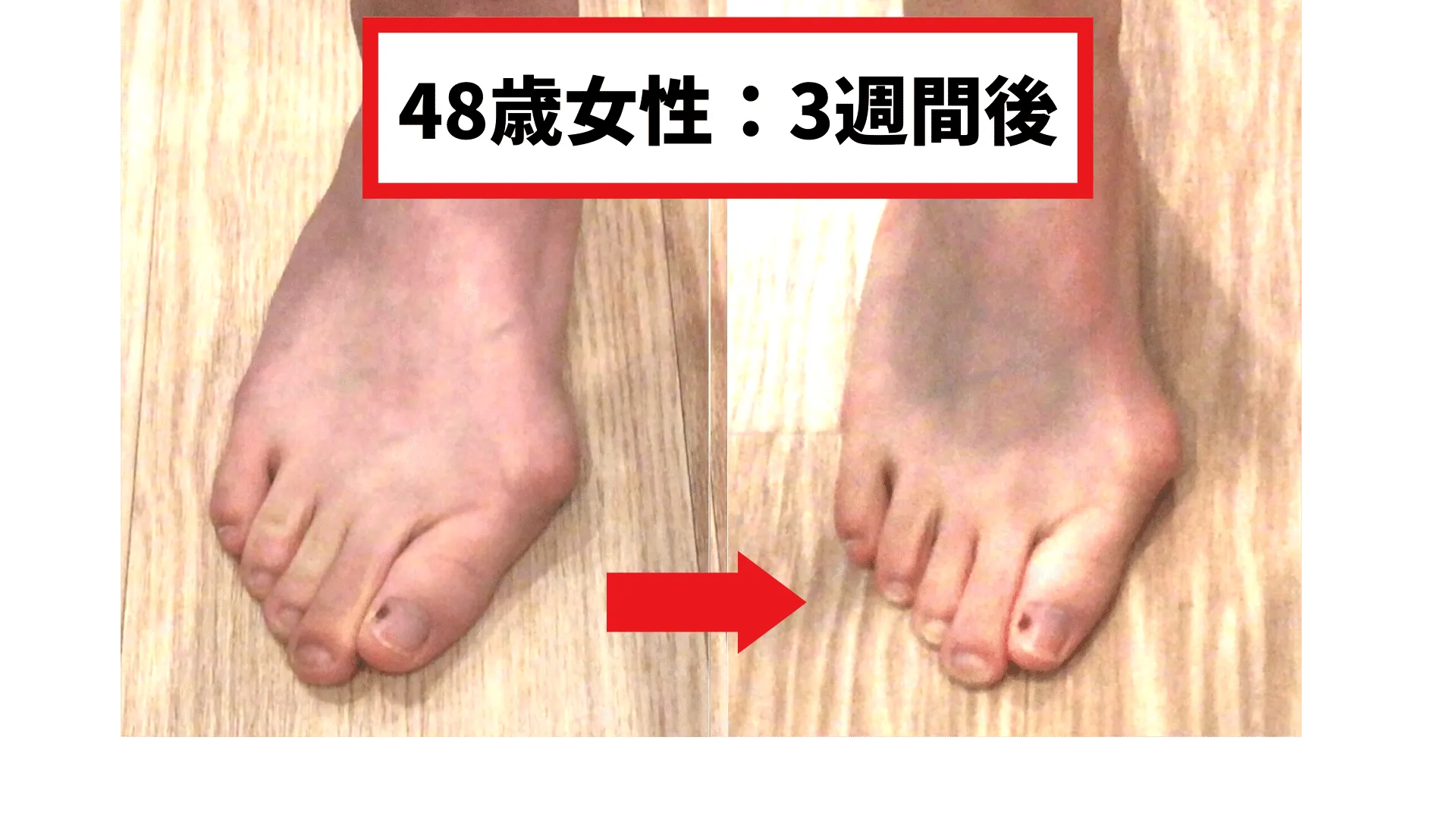 成果写真1